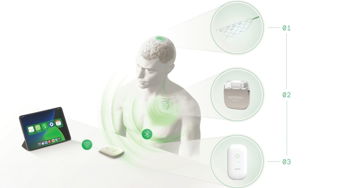 Synchron digital interpretation of its BCI being used with a tablet Synchron digital interpretation of its BCI being used with a tablet