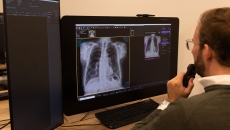 A radiologist reviewing an AI-generated chest X-ray analysis