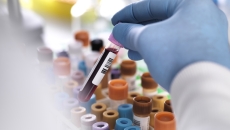 Closeup of test tube