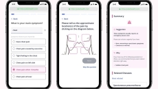 Ubie's AI symptom checker app for patients
